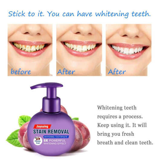 Stain Removal Whitening Toothpaste Fight Bleeding Gums Toothpaste